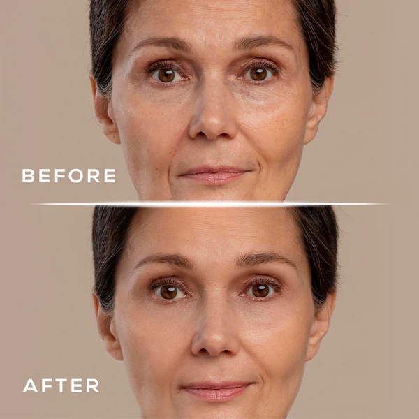 Revya- Under Eye Dark Circle Remover